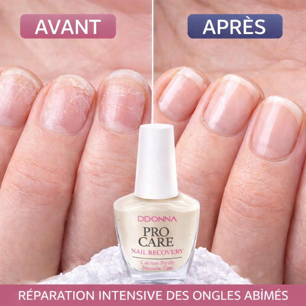 Nail Recovery 15 ml Soin Réparateur Intensif – Calcium Fortify Intensive Care – Enrichi en Kératine, Vitamines E & B5 – Renforce et Protège les Ongles Abîmés OCIBEL